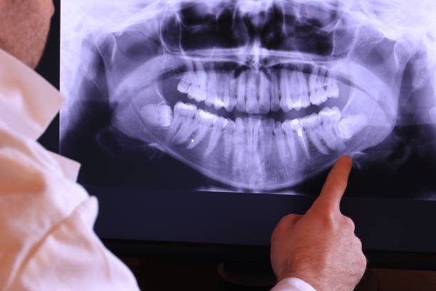 Best Cracked Tooth Emergency Dentist  in Media, PA